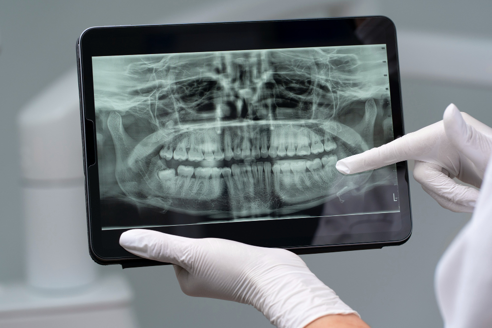 Digital dental x-ray displayed on a tablet